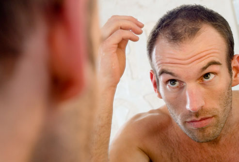 how regrow hair on bald area